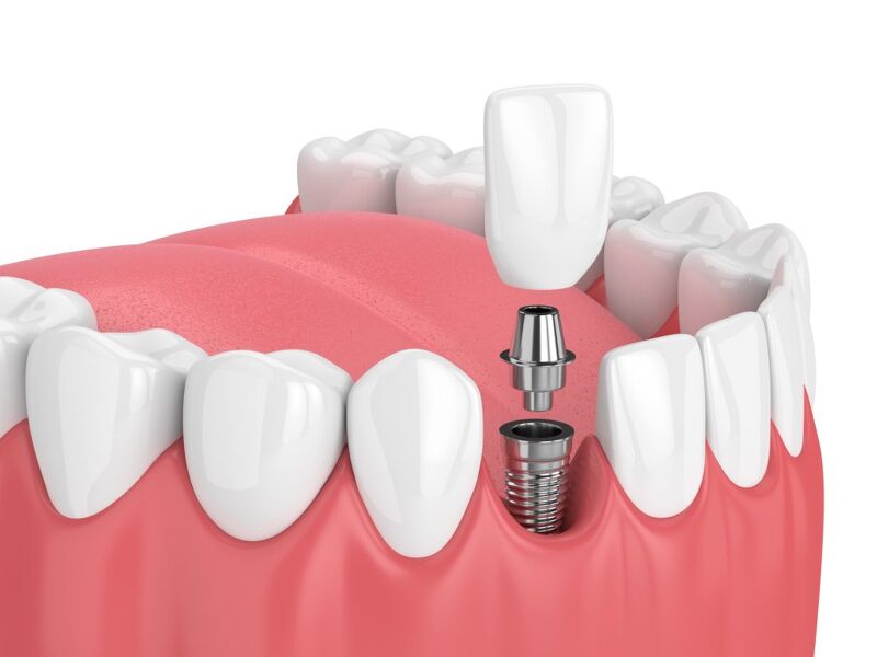 치과 관련주 대장주 8종목
