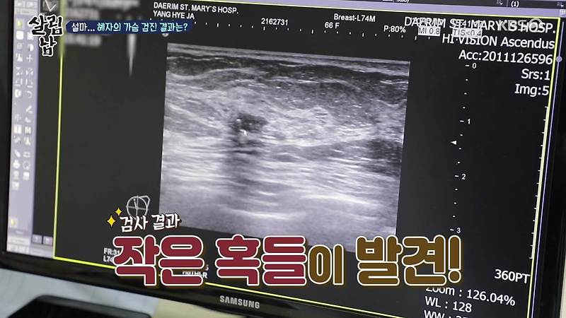 살림남2 팝핀현준 어머니 건강검진에서 소개된 유방 암 자가 검진 가슴 혹 확인 하는 방법