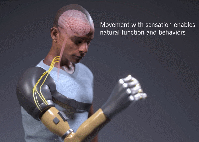 클리블랜드 클리닉, 상반신 절단 환자 위한 최초 생체 공학 팔 개발...타고난 손과 최근접  VIDEO: Cleveland Clinic Researchers Develop Bionic Arm that Restores Natural Movements, Sensation and Touch
