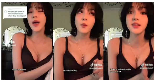 틱장애 뚜렛증후군 공개 매력 넘친다며 인기 떡상한 17살 소녀 인플루언서 키트 Keet