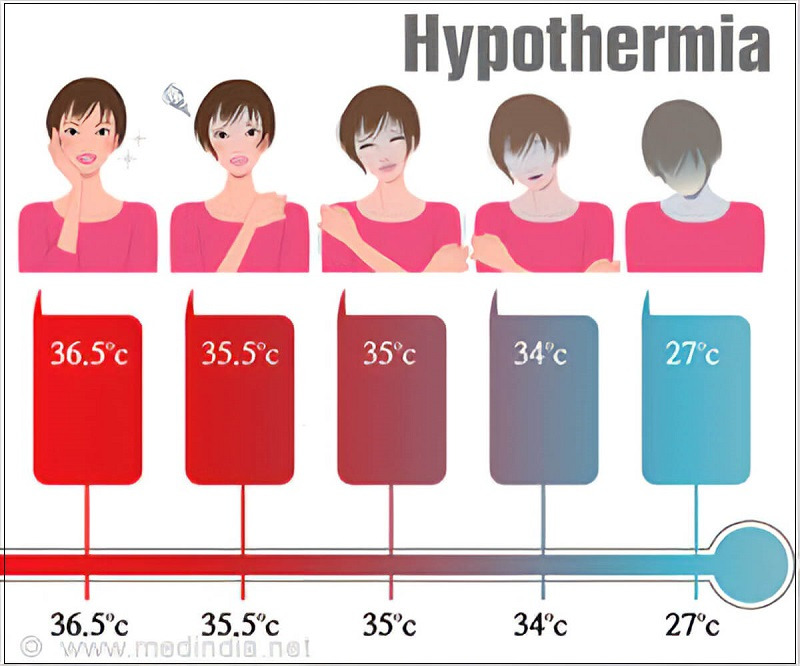 저체온증(hypothermia)