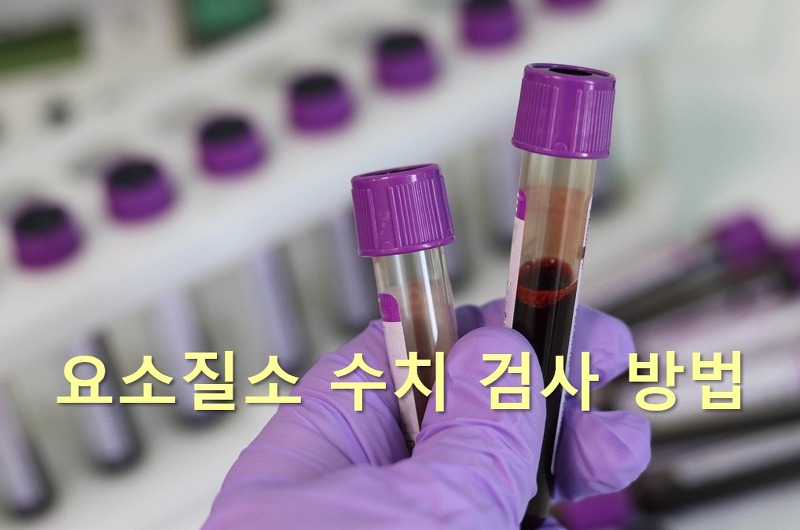 혈액 속의 요소를 측정하는 요소질소 수치 검사 방법