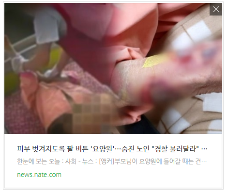 피부 벗겨지도록 팔 비튼 '요양원'…숨진 노인 
