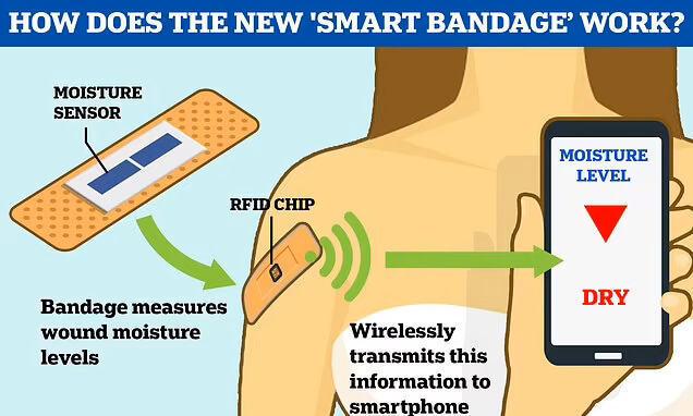 의사가 원격으로 상태를 관리하는 스마트 밴드 'New 'smart bandages' that tell doctors when a wound has healed...