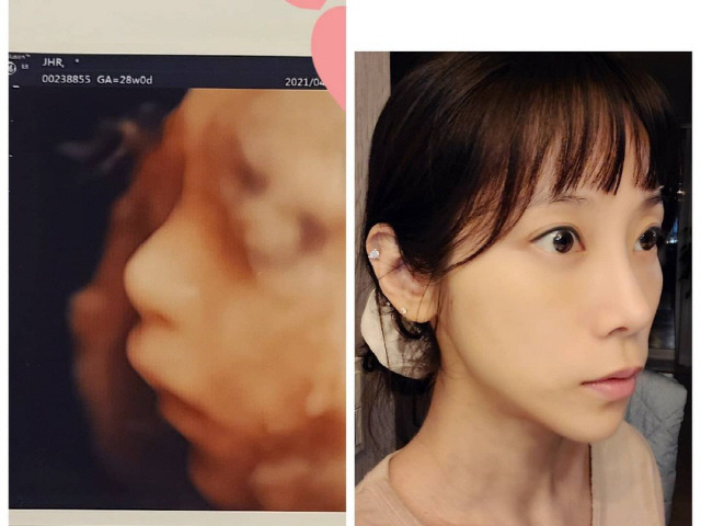 '예비맘' 조민아, 똑닮은 초음파 사진 공개...
