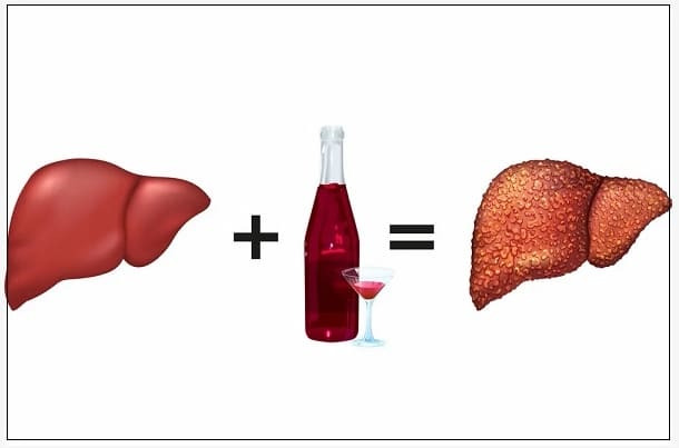 술만 간에 해악일까? ㅣ 간경변 환자의 완전한 금주는 건강 회복의 시금석 Scientists provide evidence of the positive effects of alcohol abstinence..