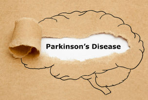 파킨슨병: 원인, 증상, 진단 및 치료에 대한 이해