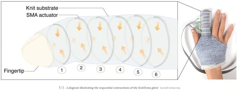 손부종 환자를 위한 로봇 섬유 VIDEO: Knitted robotic textile promising for hand edema patients