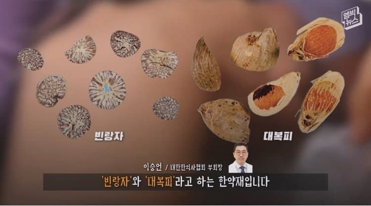 구강암 발암물질 (빈랑 빈랑자 대복피 한약재)