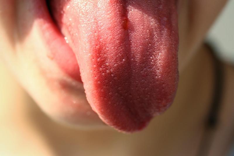 혀 백태 원인과 혓바닥과 건강의 관계