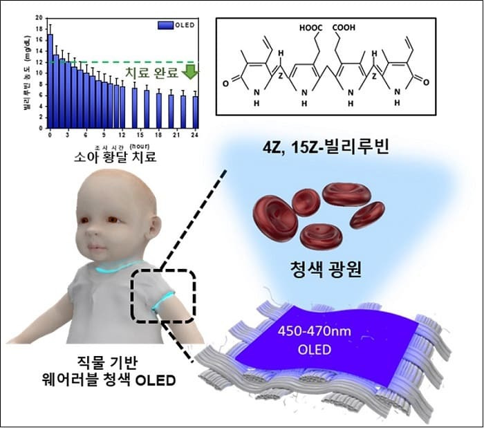 카이스트, 입을 수 있는 OLED로 소아 황달 치료기술 개발