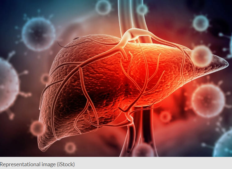 놀라운 백년 수명의 '간' Transplanted livers can keep going for a total of more than 100 years, according to new research