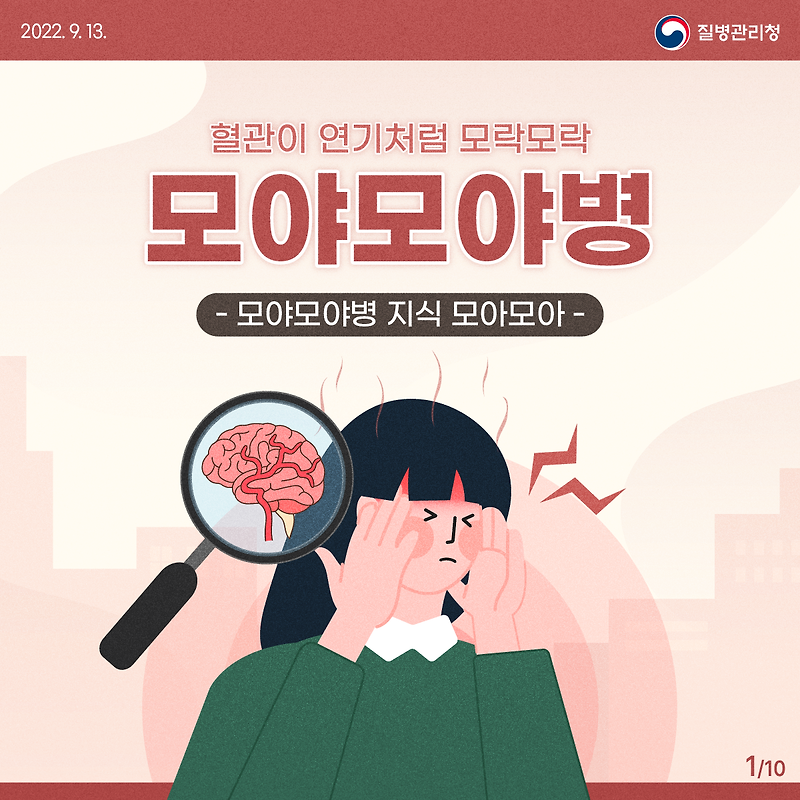 모야모야병 원인 증상 진단 치료