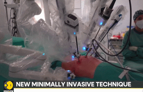 스페인, 로봇만으로 세계 최초 폐 이식 수술 성공 VIDEO:Spain sees the world's first lung transplant performed entirely by robot