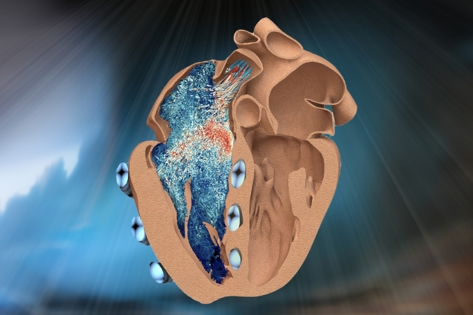 MIT, 심장 우심실 로봇으로 복제 MIT engineers design a robotic replica of the heart’s right chamber