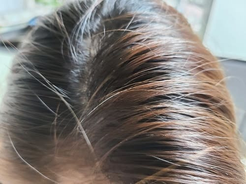 새치(White and gray hair), 뽑지 말고 잘라라  White hair: Causes and ways to prevent it