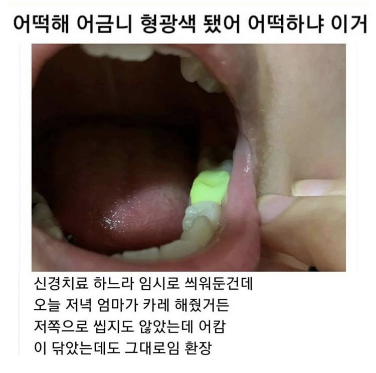 (유머) 어금니 형광색 어떡해