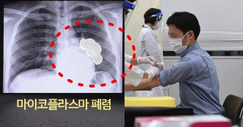'중국 확산' 마이코플라즈마 폐렴 증상 생각 이상으로 위험한 진짜 이유 (관련주, 백신, 치료제, 합병증, 한국)