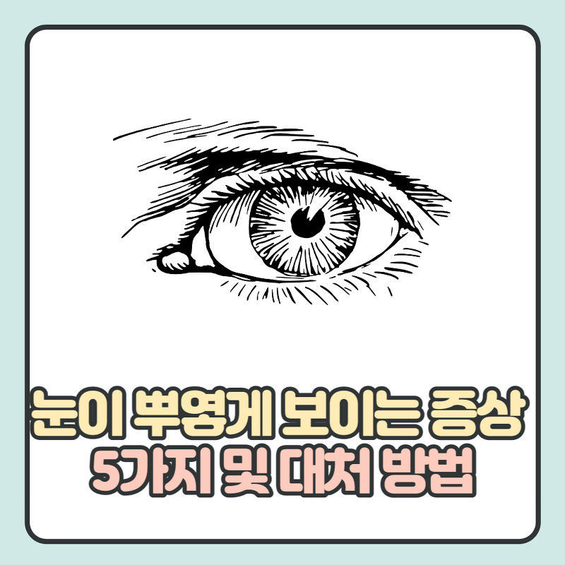 눈이 뿌옇게 보이는 증상 5가지 이유 및 대처 방법 알아보기
