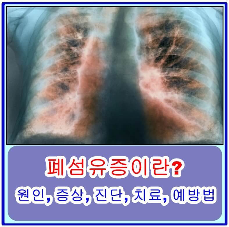 폐섬유증이란? 원인, 증상, 진단, 치료, 예방법 총정리