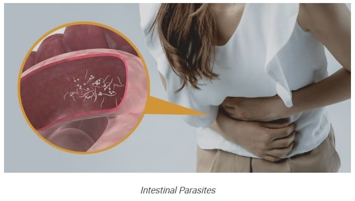 내 뱃 속에 기생충이 있다는 신호들 5 signs you may have intestinal parasites