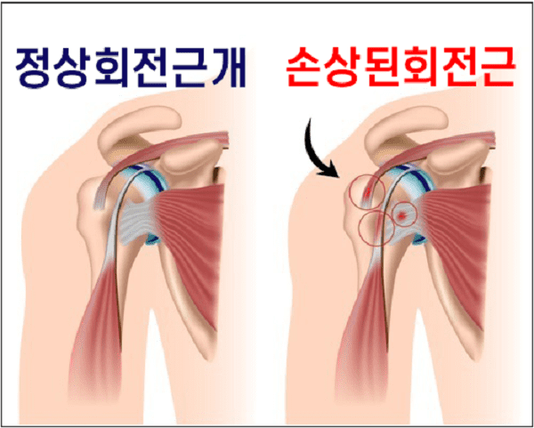 하루 종일 책상 앞에서 일하다 보니 어깨가....