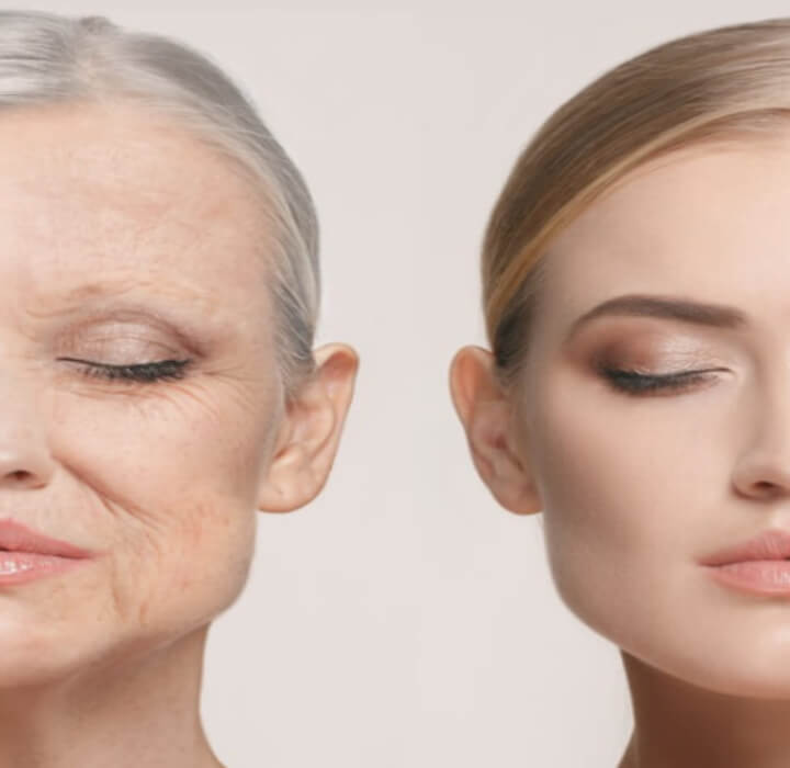 피부 노화 방지 비법 - 노화의 증상과 원인