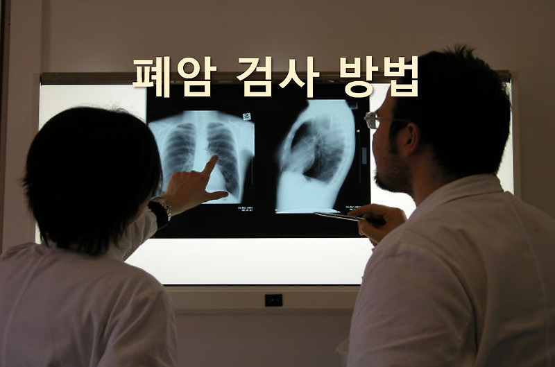 폐조직에 악성종양을 진단하는 폐암 검사 방법