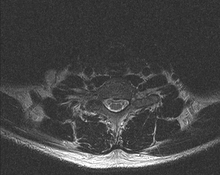 t-spine axial scan