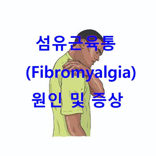 섬유근육통(Fibromyalgia) 원인 및 증상