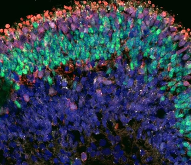 시력 상실자에게 희망...세계 최초 인공 망막 만들어 VIDEO: Second Sight engineered an artificial retina bionic eye