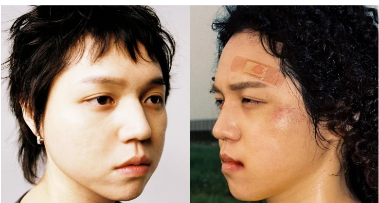 금쪽상담소 원슈타인 정지원 '난 학폭피해자 집단폭행 당해' 자해 고백 나이 프로필