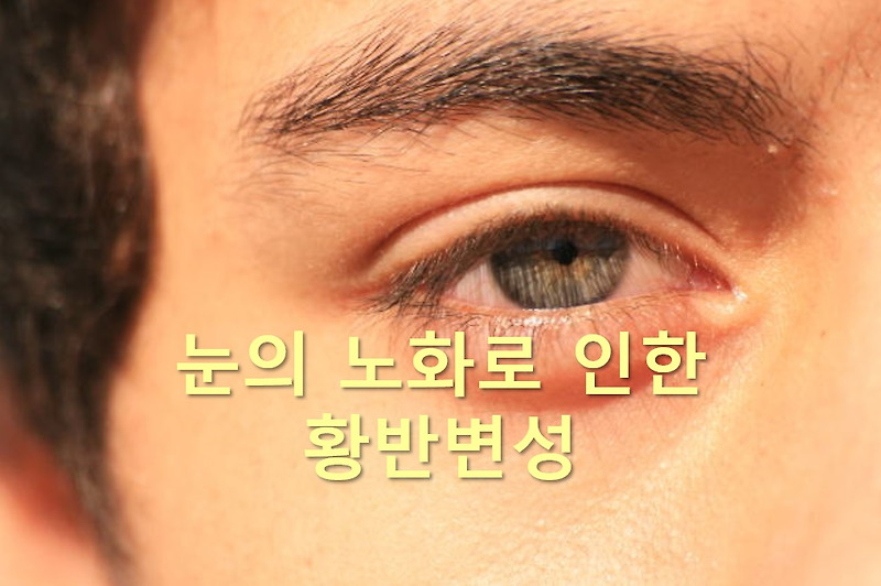 눈의 노화를 예방해주는 눈 영양제 3가지