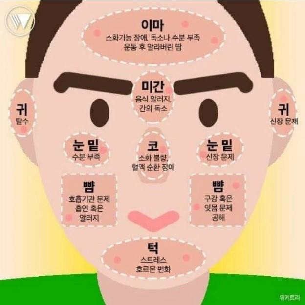 얼굴에 여드름 나는 이유