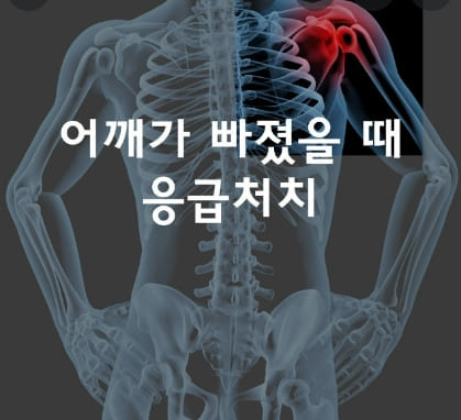 어깨 빠졌을 때 대처 방법