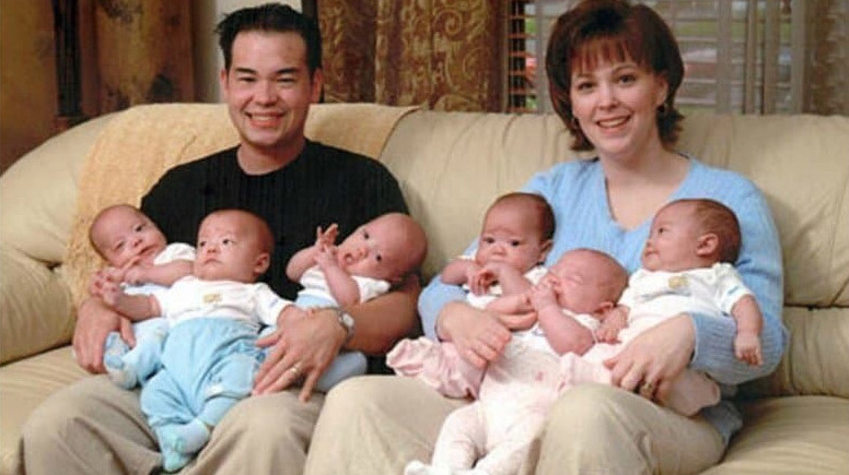 6쌍둥이를 임신한 산모