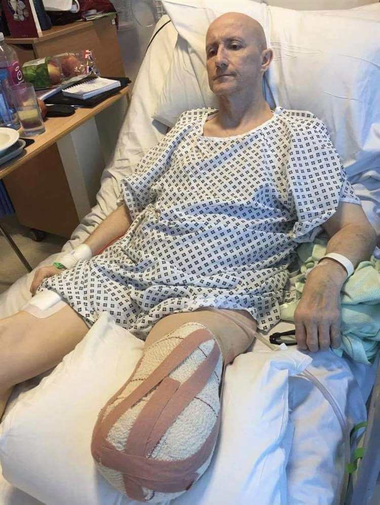 전 태권도 챔피언 영국 남성 AZ 접종 후 다리 절단  Stamford man vows to battle back after losing his leg weeks after receiving AstraZeneca Covid-19 vaccination