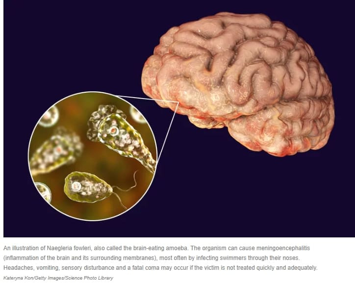 치사율 97% '뇌 파먹는 아메바' 국내 첫 감염 확인...감염자 10일만 사망