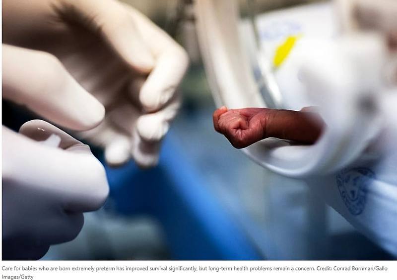 '인공자궁' 개발 동향...인간 실험 곧 착수...저출산 대책도 기대 VIDEO: Human trials of artificial wombs could start soon. Here’s what you need to know