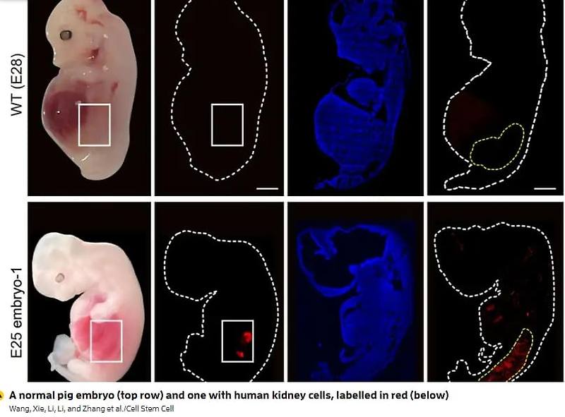 재생 불가능한 '인간 신장', 세계 최초 돼지 배아에서 자라 VIDEO: Human kidneys have been partially grown in pigs for the first time