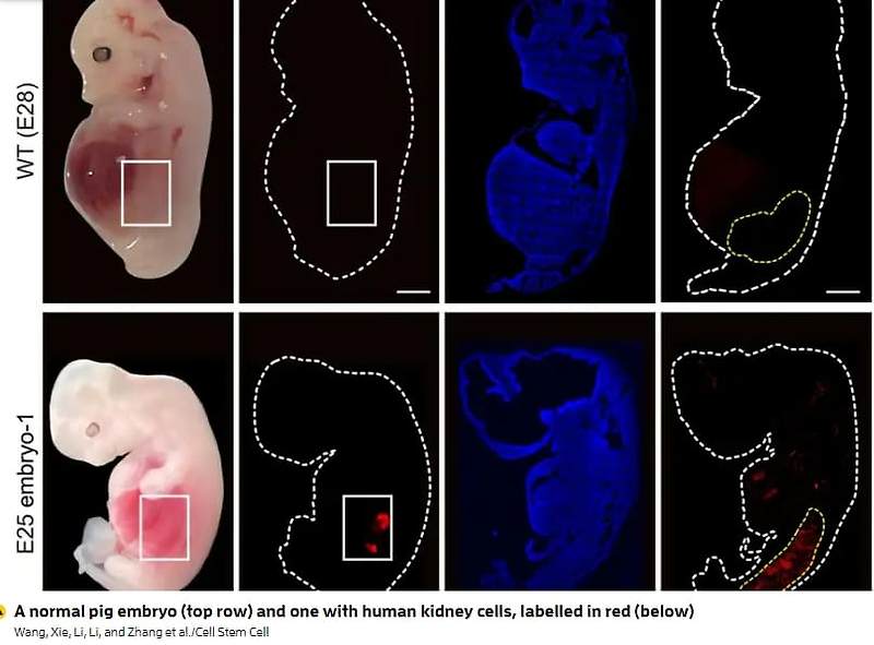 재생 불가능한 '인간 신장', 세계 최초 돼지 배아에서 자라 VIDEO: Human kidneys have been partially grown in pigs for the first time