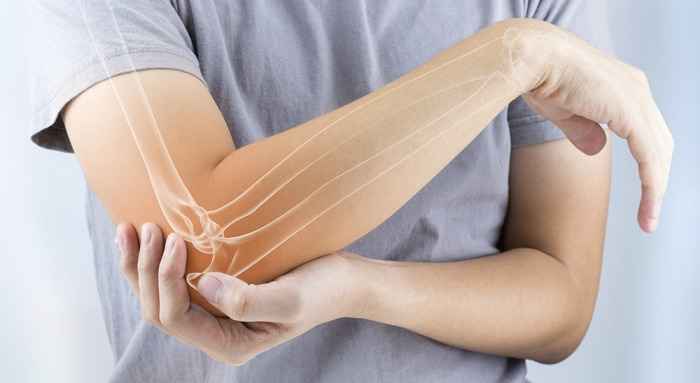 팔꿈치가 아파요(1) 테니스 엘보우(tennis elbow, lateral epicondilitis)