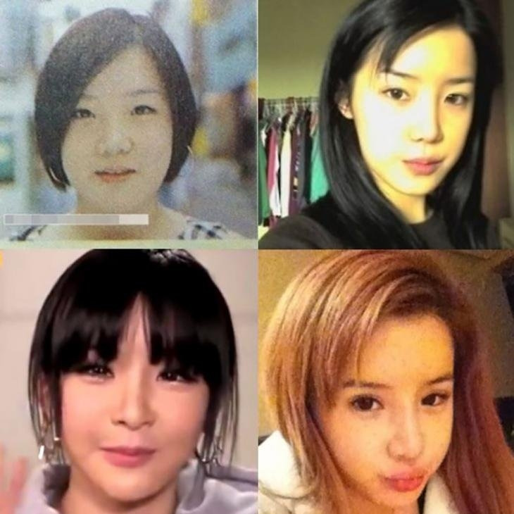 박봄 리즈 얼굴 변천사