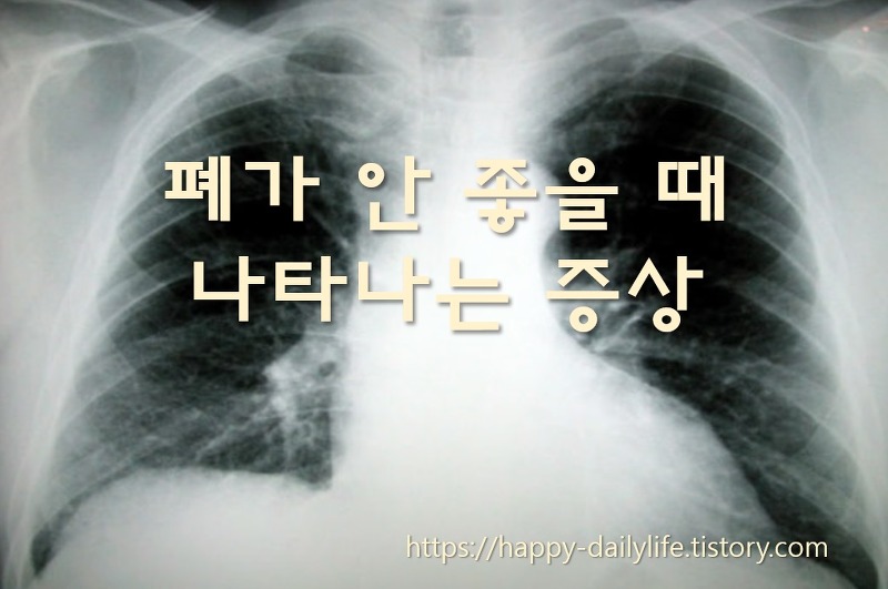 폐가 안 좋을 때 나타나는 증상과 폐가 좋아지는 음식