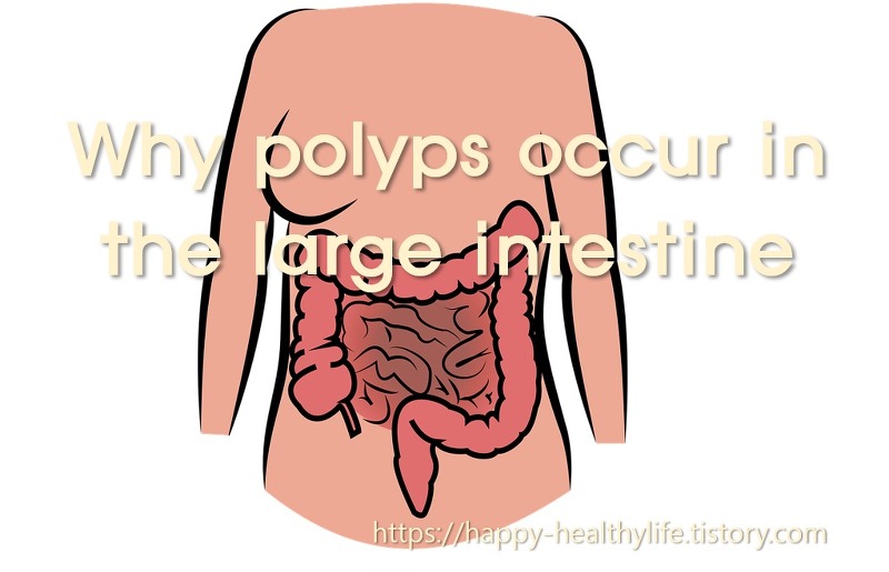 Why polyps develop in the large intestine, good and bad food for the large intestine