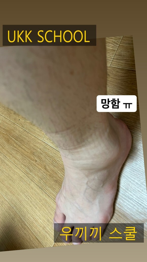자꾸만 꺾이는 발목... 이제 안녕!! 이제 그만!!