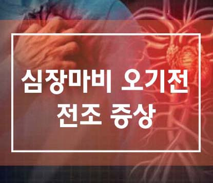심장마비 오기전 나타나는 전조 증상