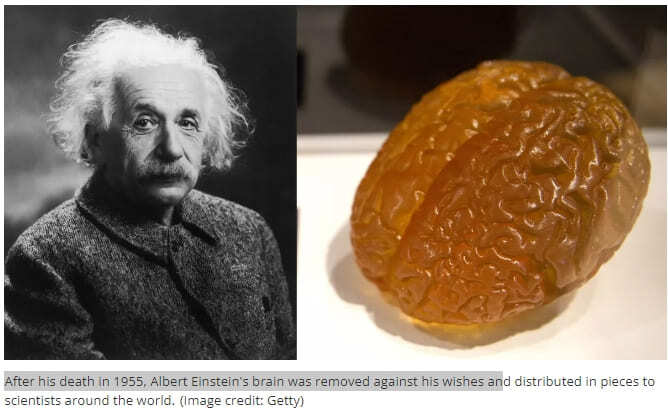 아인슈타인의 뇌는 지금 어디에 있을까? VIDEO: Where is Einstein's brain?