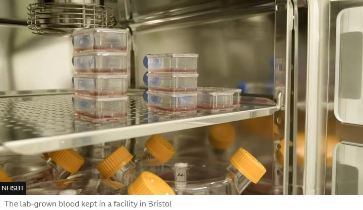 이제 헌혈 안해도 되나?...실험실 배양 혈액, 세계 최초 임상시험 투여 VIDEO:Lab-grown blood given to people in world-first clinical trial