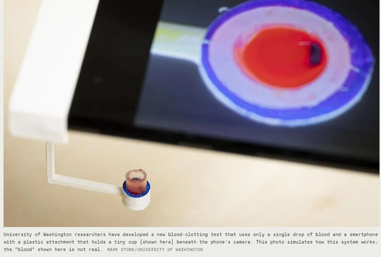스마트폰에 피 한 방울만 떨어뜨리면...ㅣ 세계 AI 컴퓨터 신기록  인텔과 엔비디아  Blood Test Only Needs a Drop and a Smartphone for Results ㅣ New Records for the Biggest and Smallest AI Computers